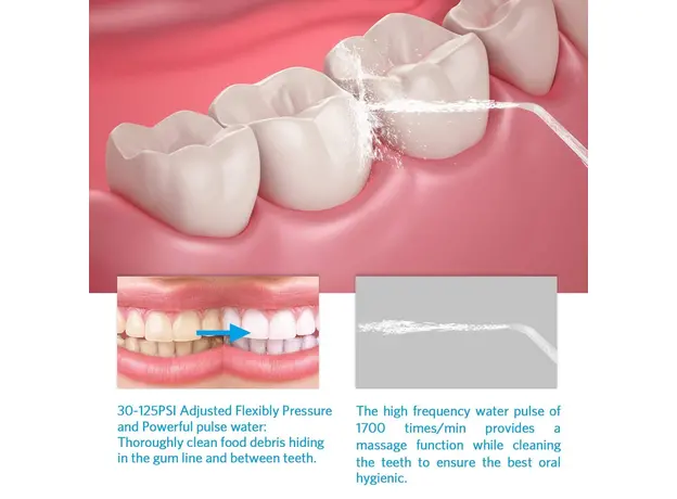 Ирригатор PECHAM Professional (6902018567809) - изображение 6