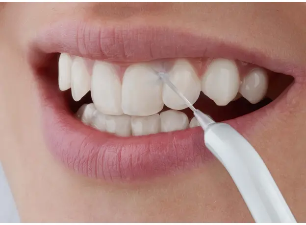 Ирригатор Sencor SOI2200SL - изображение 9