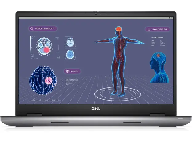 Ноутбук Dell Precision 17 7780 [N003P7780ADA006WP] 
